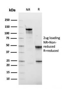 SDS-PAGE analysis of Anti-Fibronectin Antibody [FN1/2949] under non-reduced and reduced conditions; showing intact IgG and intact heavy and light chains, respectively. SDS-PAGE analysis confirms the integrity and purity of the antibody