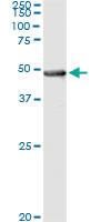 Anti-PIPOX Mouse Monoclonal Antibody [clone: 3D1]