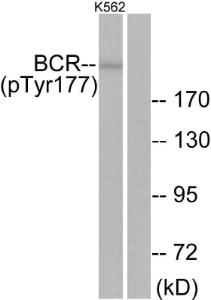 Western blot analysis of lysates from K562 cells using Anti-Bcr (phospho Tyr177) Antibody. The right hand lane represents a negative control, where the antibody is blocked by the immunising peptide.