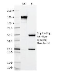 Antibody anti-MUC2 CCP58 100 µg