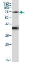 Anti-ITK Polyclonal Antibody Pair