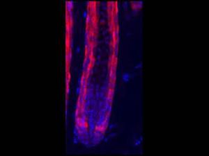 RFP antibody ADSOR 25 µl