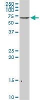 Anti-NEFL Rabbit Polyclonal Antibody