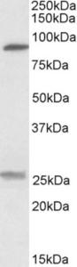 EB09681 (0.3 µg/ml) staining of Human Kidney lysate (35 µg protein in RIPA buffer). Primary incubation was 1 hour. Detected by chemiluminescence.