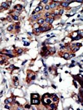 Anti-PACSIN3 Rabbit Polyclonal Antibody (Biotin)