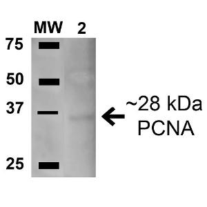 Western blot analysis of human Embryonic kidney epithelial cell line (HEK293T) lysate showing detection of ~28.7 kDa PCNA protein using Anti-PCNA Antibody (A304847) at 1:1,000 for 1 hour. Lane 1: Molecular Weight Ladder (MW). Lane 2: human 293Trap cell