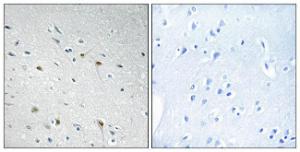 Immunohistochemical analysis of paraffin-embedded human brain tissue using Anti-CDC25C Antibody. The right hand panel represents a negative control, where the antibody was pre-incubated with the immunising peptide