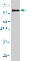 Anti-TDP1 Mouse Monoclonal Antibody [clone: 2A10-G2]