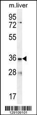 Anti-LDLRAD3 Rabbit Polyclonal Antibody (HRP (Horseradish Peroxidase))