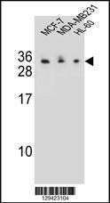 Anti-C1QL4 Rabbit Polyclonal Antibody (APC (Allophycocyanin))