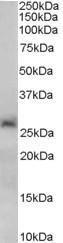 Anti-SIRT3 Antibody (A82814) (0.2 µg/ml) staining of Human Liver lysate (35 µg protein in RIPA buffer). Primary incubation was 1 hour. Detected by chemiluminescence