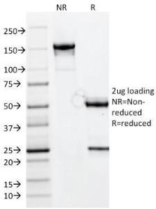 SDS-PAGE analysis of Anti-CELA3B Antibody [CELA3B/1811] under non-reduced and reduced conditions; showing intact IgG and intact heavy and light chains, respectively SDS-PAGE analysis confirms the integrity and purity of the antibody