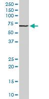 Anti-CHAT Goat Polyclonal Antibody