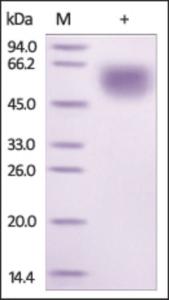 The purity of rh IL1RL1 /ST2 was determined by DTT-reduced (+) SDS-PAGE and staining overnight with Coomassie Blue.