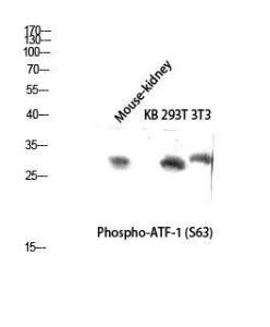 Western blot analysis of mouse kidney KB 293T 3T3 lysis using Anti-ATF1 (phospho Ser63) Antibody