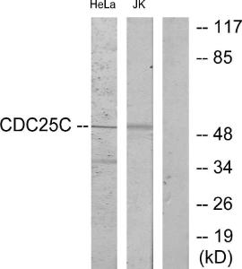 Western blot analysis of lysates from HeLa and Jurkat cells using Anti-CDC25C Antibody. The right hand lane represents a negative control, where the antibody is blocked by the immunising peptide.