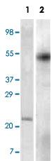 Anti-FOXP3 Monoclonal Antibody [clone: 2A11G9, 2A11C2]