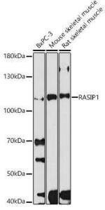 Anti-RAIN antibody