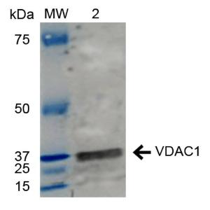 Western blot analysis of human HeLa showing detection of ~37 kDa VDAC1 protein using Anti-VDAC1/Porin Antibody (A304848) at 1:1000 for 2 hours at room temperature. Lane 1: Molecular Weight Ladder (MW). Lane 2: HeLa cell lysates. Load: 15 µg.