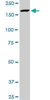 Anti-KDM5B Mouse Monoclonal Antibody [clone: 1G10]