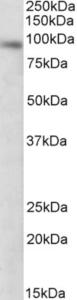 EB09706 (0.3 µg/ml) staining of NIH3T3 lysate (35 µg protein in RIPA buffer). Primary incubation was 1 hour. Detected by chemiluminescence.