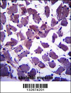 Anti-HSPA12B Rabbit Polyclonal Antibody (Biotin)