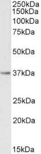 Anti-PTGR1 Antibody (A82816) (0.3 µg/ml) staining of Human Kidney lysate (35 µg protein in RIPA buffer). Primary incubation was 1 hour. Detected by chemiluminescence