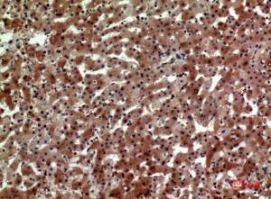 Anti-CD163L1 antibody