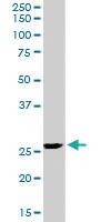 Anti-SRD5A2 Goat Polyclonal Antibody