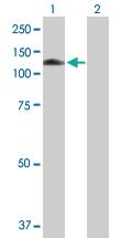 Anti-MANBA Mouse Polyclonal Antibody