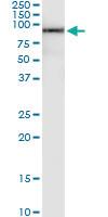 Anti-TDP1 Polyclonal Antibody Pair