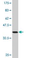 Anti-FXN Mouse Monoclonal Antibody [clone: 1D9]