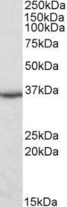 Anti-DDAH1 Antibody (A82817) (0.1 µg/ml) staining of Human Kideny lysate (35 µg protein in RIPA buffer). Detected by chemiluminescence