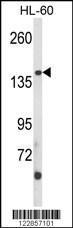 Anti-MST1R Rabbit Polyclonal Antibody (HRP (Horseradish Peroxidase))