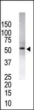 Anti-USP14 Rabbit Polyclonal Antibody (APC (Allophycocyanin))