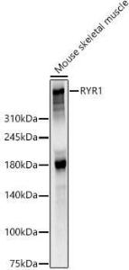 Anti-Ryanodine Receptor antibody