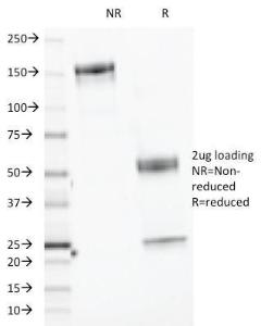 SDS-PAGE analysis of Anti-CELA3B Antibody [CELA3B/1218] under non-reduced and reduced conditions; showing intact IgG and intact heavy and light chains, respectively. SDS-PAGE analysis confirms the integrity and purity of the antibody