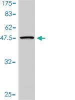 Anti-UBE2H Mouse Monoclonal Antibody [clone: 3C4-1A2]