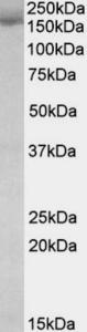 EB09717 (0.03 µg/ml) staining of K562 lysate (35 µg protein in RIPA buffer). Primary incubation was 1 hour. Detected by chemiluminescence.