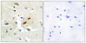 Anti-REV3L Rabbit Polyclonal Antibody