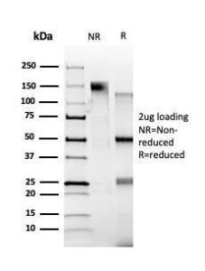 SDS-PAGE analysis of Anti-ZBTB39 Antibody [PCRP-ZBTB39-1A11] under non-reduced and reduced conditions; showing intact IgG and intact heavy and light chains, respectively. SDS-PAGE analysis confirms the integrity and purity of the antibody.