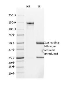 SDS-PAGE analysis of Anti-MUC2 Antibody [SPM513] under non-reduced and reduced conditions; showing intact IgG and intact heavy and light chains, respectively. SDS-PAGE analysis confirms the integrity and purity of the antibody