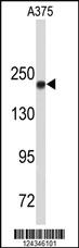 Anti-TOP2A Rabbit Polyclonal Antibody