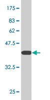 Anti-DDX1 Mouse Monoclonal Antibody [clone: 4F6]