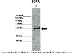 Anti-EGFR Rabbit Polyclonal Antibody