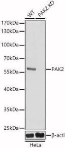 Anti-PAK2 Rabbit Polyclonal Antibody