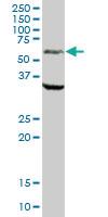 Anti-MAOA Mouse Polyclonal Antibody