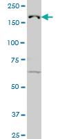 Anti-KDM5B Mouse Monoclonal Antibody [clone: 1G10]