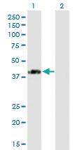 Anti-SPG11 Mouse Polyclonal Antibody