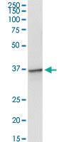 Anti-TOLLIP Polyclonal Antibody Pair